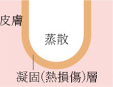 CO2レーザーのイメージ