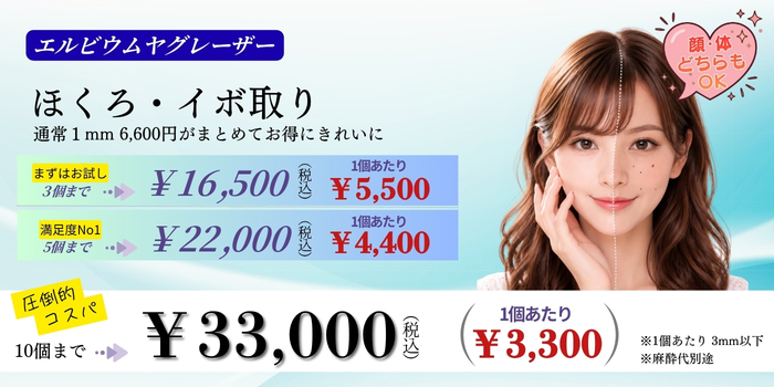 エルビウムヤグレーザーによるほくろ取り。10個33,000円、5個22,000円