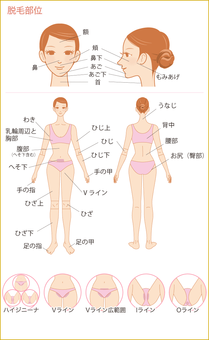 脱毛部位