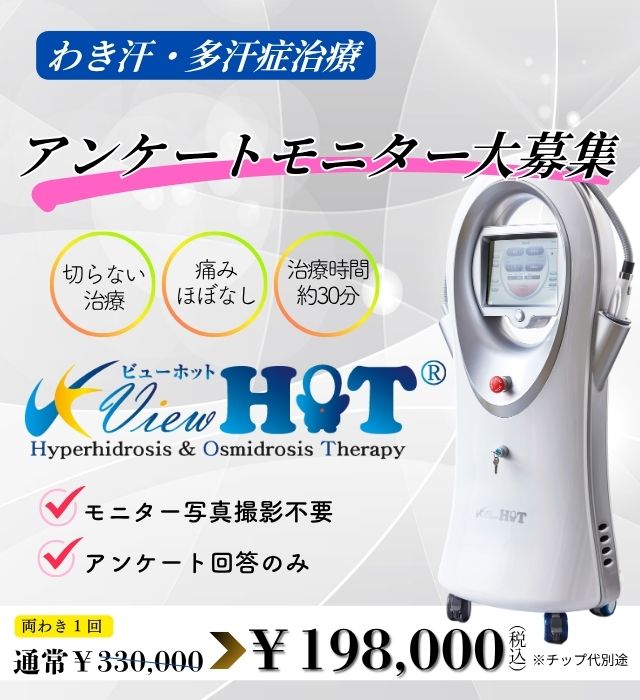 アンケートモニター大募集 ビューホット