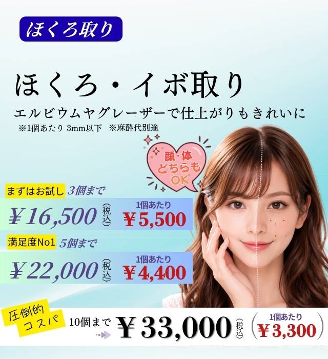 ほくろ取り 10個33,000円 5個22,000円